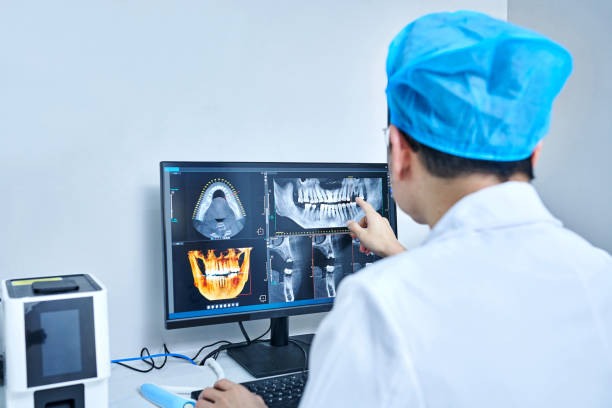 Best Emergency Wisdom Tooth Extraction in Los Lunas, NM